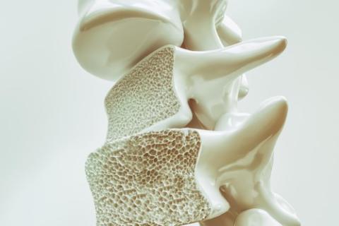 Osteoporoza
